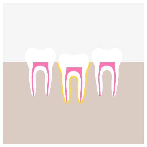 Traumatic Dental Injuries